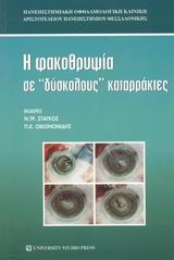 Η φακοθρυψία σε δύσκολους καταρράκτες